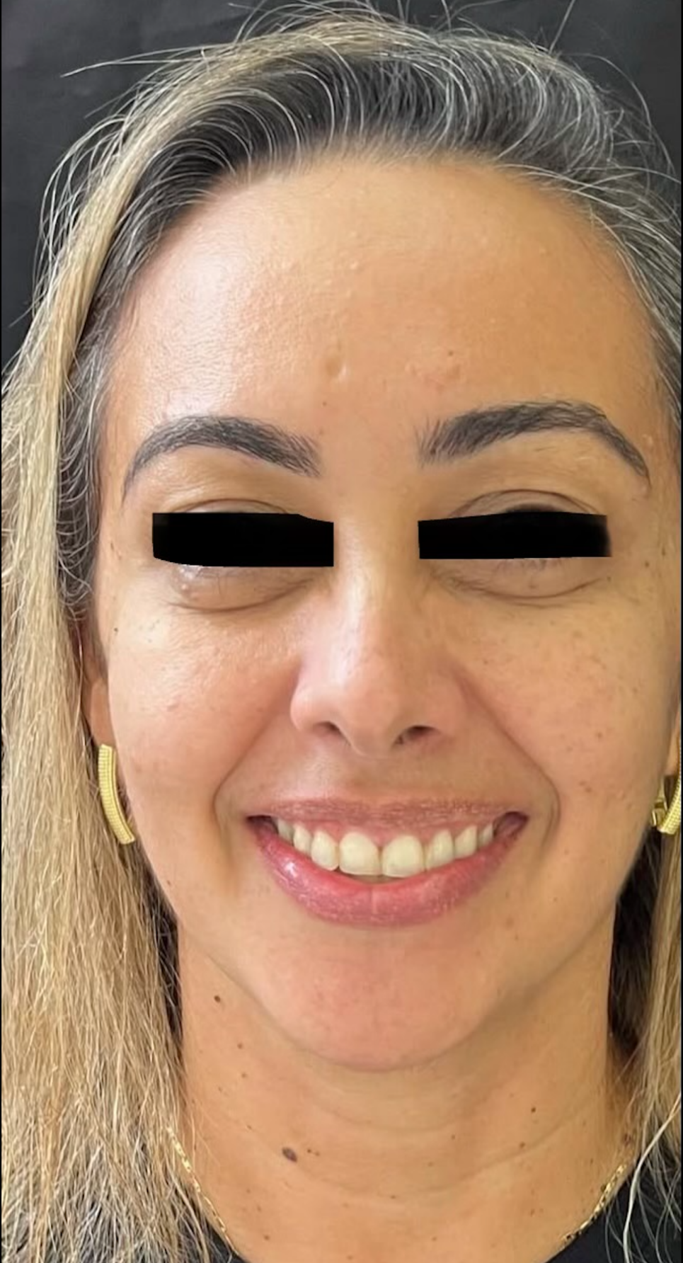 Despues