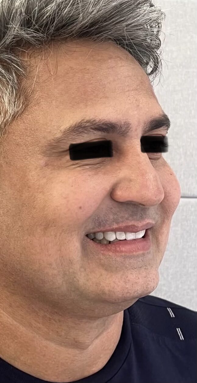 Despues