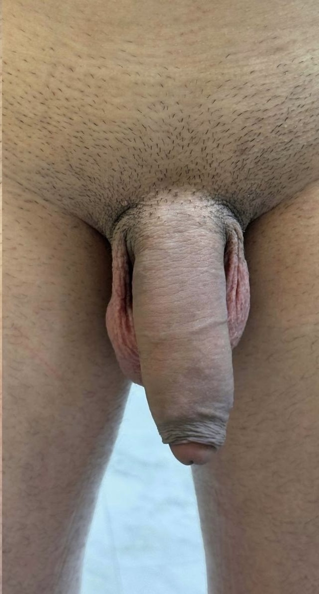 Despues