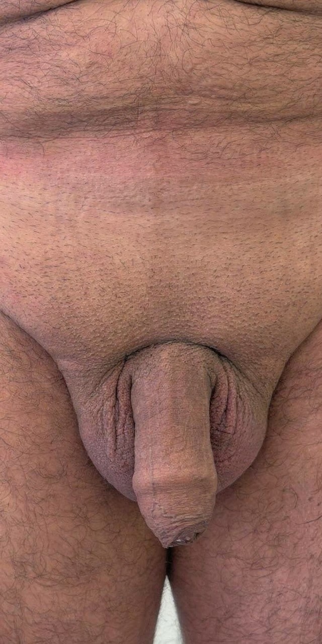 Antes