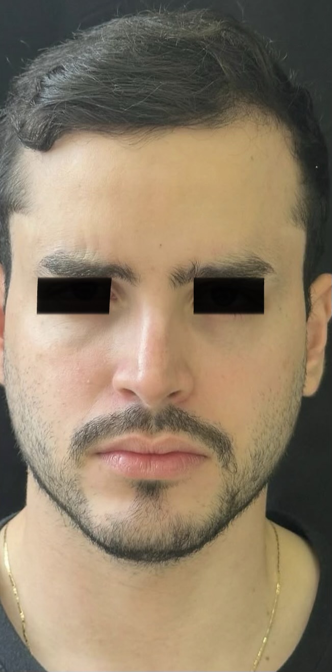 Despues