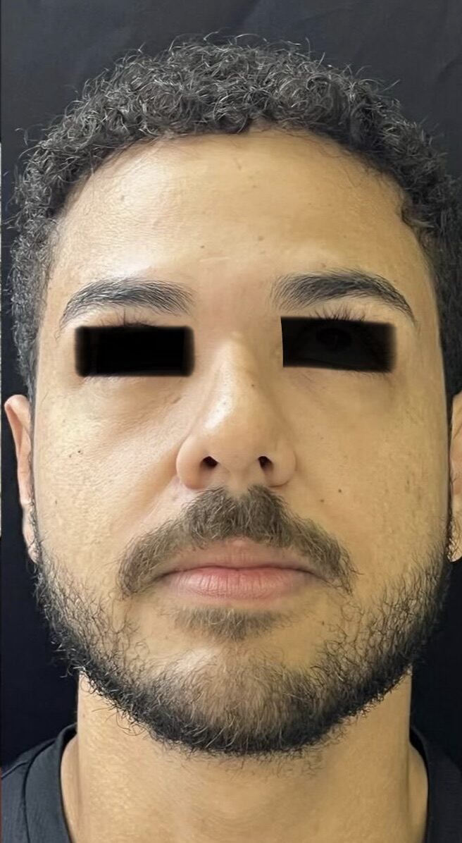 Despues