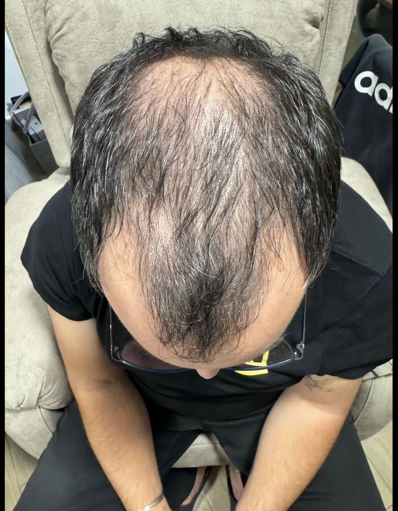 Antes