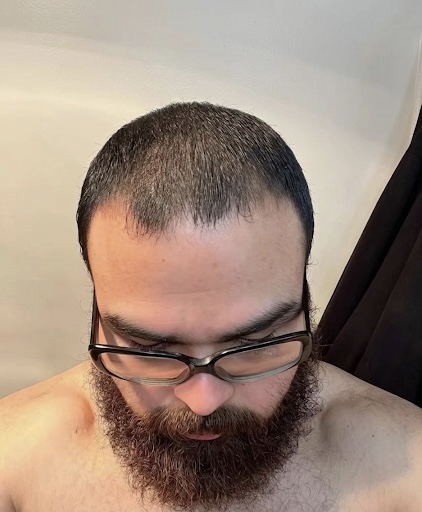 Despues